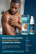 Dites adieu aux cicatrices grâce à ce vrai gel médical
